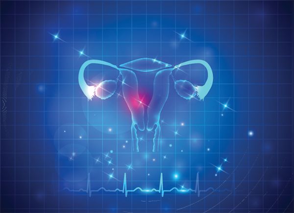 POLYCYSTIC OVARY SYNDROME