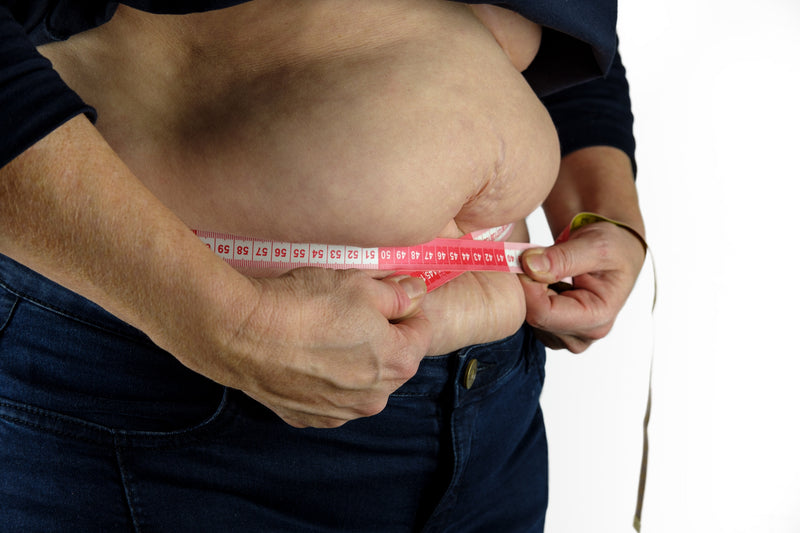 OBESITY